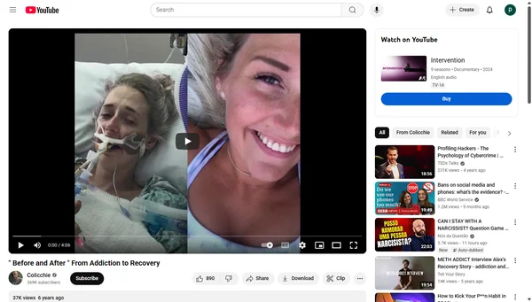 Before and After: From Addiction to Recovery